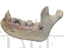 Didactic jaw