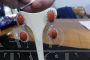 Double drop earrings in white gold with diamonds and Sardinia coral